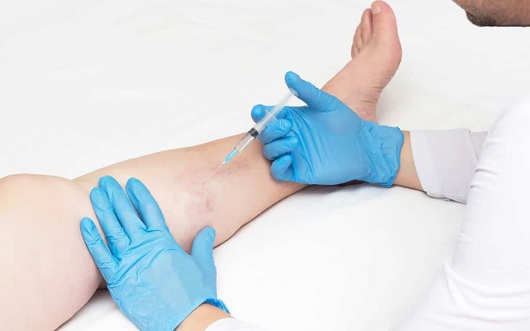 Cirurgia vascular no Complexo Hospitalar Reunidas